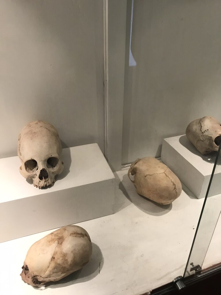 Deformed skulls in the museum in Cusco